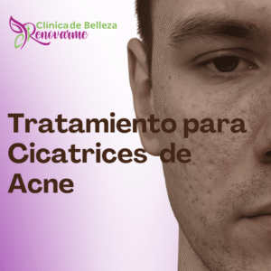TRATAMIENTOS FACIALES EN CLINICA DE BELLEZA RENOVARME, TRATAMIENTOS PARA LA ALOPECIA, CLINICA DE PELO (5)
