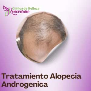 clinica de belleza renovarme, clinica renovarme, tratamientos faciales, tratamientos para la alopecia, tratamientos faciales, clinica de estetica en san jose, costa rica (10)