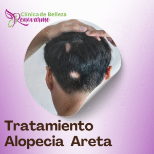 clinica de belleza renovarme, clinica renovarme, tratamientos faciales, tratamientos para la alopecia, tratamientos faciales, clinica de estetica en san jose, costa rica (11)