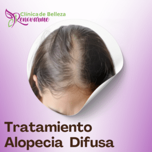 clinica de belleza renovarme, clinica renovarme, tratamientos faciales, tratamientos para la alopecia, tratamientos faciales, clinica de estetica en san jose, costa rica (12)