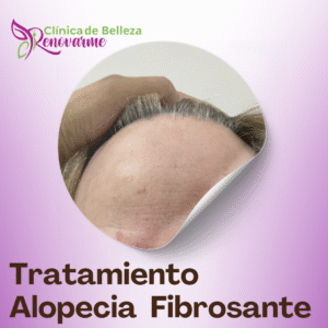 clinica de belleza renovarme, clinica renovarme, tratamientos faciales, tratamientos para la alopecia, tratamientos faciales, clinica de estetica en san jose, costa rica (13)