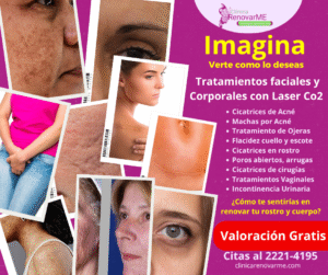 tratamientos faciales con co2 fracionado en clinica en costa rica - clinica renovarme