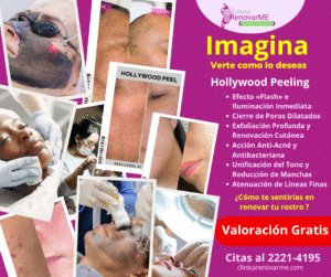 tratamientos faciales con hollywood peeling- tratamientos faciales- limpieza facial - clinicas de esteica en costa roica- clinica renovarme