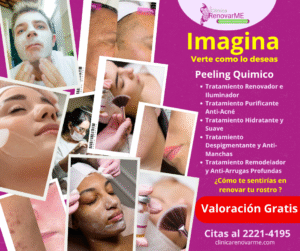 tratamientos faciales con peeling quimico