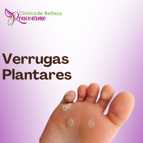 tratamientos de uñas encarnadas, tratamientos para hongos en uñas, pedicure clinico, tratamiento laser para hongos en uñas, clinica delpie, clinica de pies y uñas (3) tratamientos de uñas encarnadas, tratamientos para hongos en uñas, pedicure clinico, tratamiento laser para hongos en uñas, clinica delpie, clinica de pies y uñas (3)