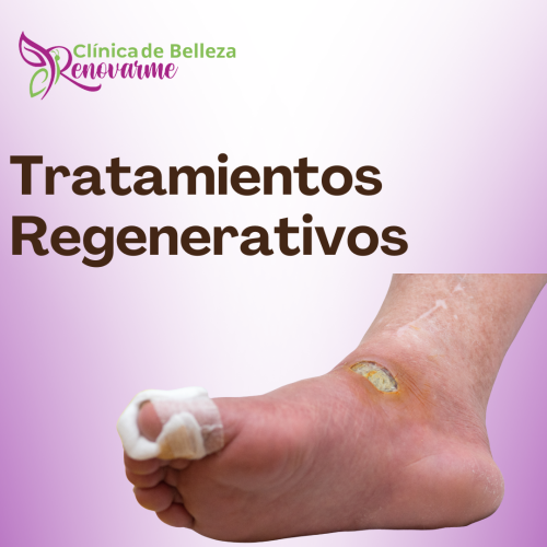 tratamientos de uñas encarnadas, tratamientos para hongos en uñas, pedicure clinico, tratamiento laser para hongos en uñas, clinica delpie, clinica de pies y uñas (6) tratamientos de uñas encarnadas, tratamientos para hongos en uñas, pedicure clinico, tratamiento laser para hongos en uñas, clinica delpie, clinica de pies y uñas (6)